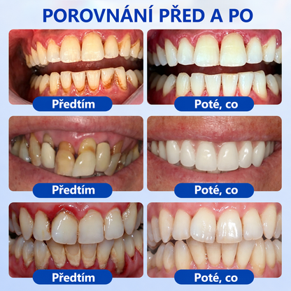 🇪🇺🏅🦷 Evolvion® GumRevive Gel na regeneraci parodontu 🔥