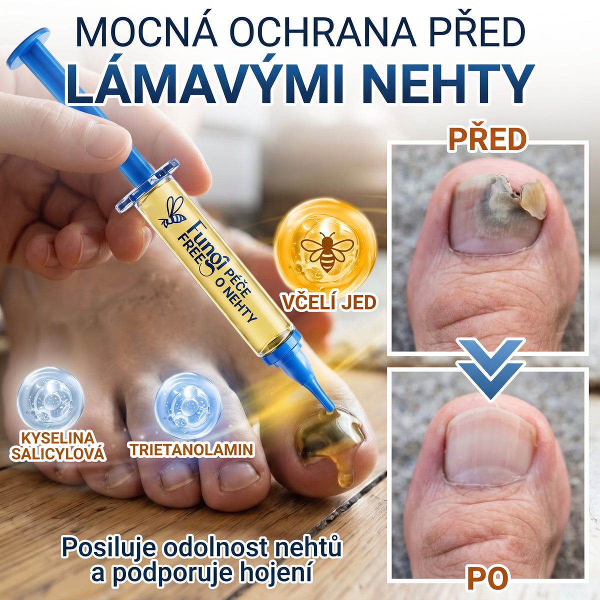 🇪🇺 Certyfikowany w UE 👩‍🔬 CareBreeze® Fungi Free – Intensywna Kuracja do Paznokci na Bazie Jadu Pszczelego ✨