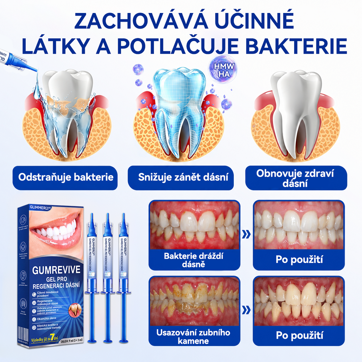 🇪🇺🏅🦷 Evolvion® GumRevive Gel na regeneraci parodontu 🔥