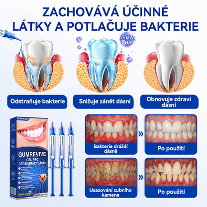 🇪🇺🏅🦷 Evolvion® GumRevive Gel na regeneraci parodontu 🔥