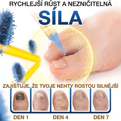 🇪🇺 Certyfikowany w UE 👩‍🔬 CareBreeze® Fungi Free – Intensywna Kuracja do Paznokci na Bazie Jadu Pszczelego ✨