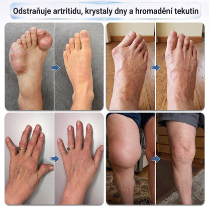 OFICIÁLNÍ OBCHOD | IFMAGIC® 0,05 mm Mikroneedle Rychle Působící Roll-On pro Úlevu Kloubů a Kostí🔥