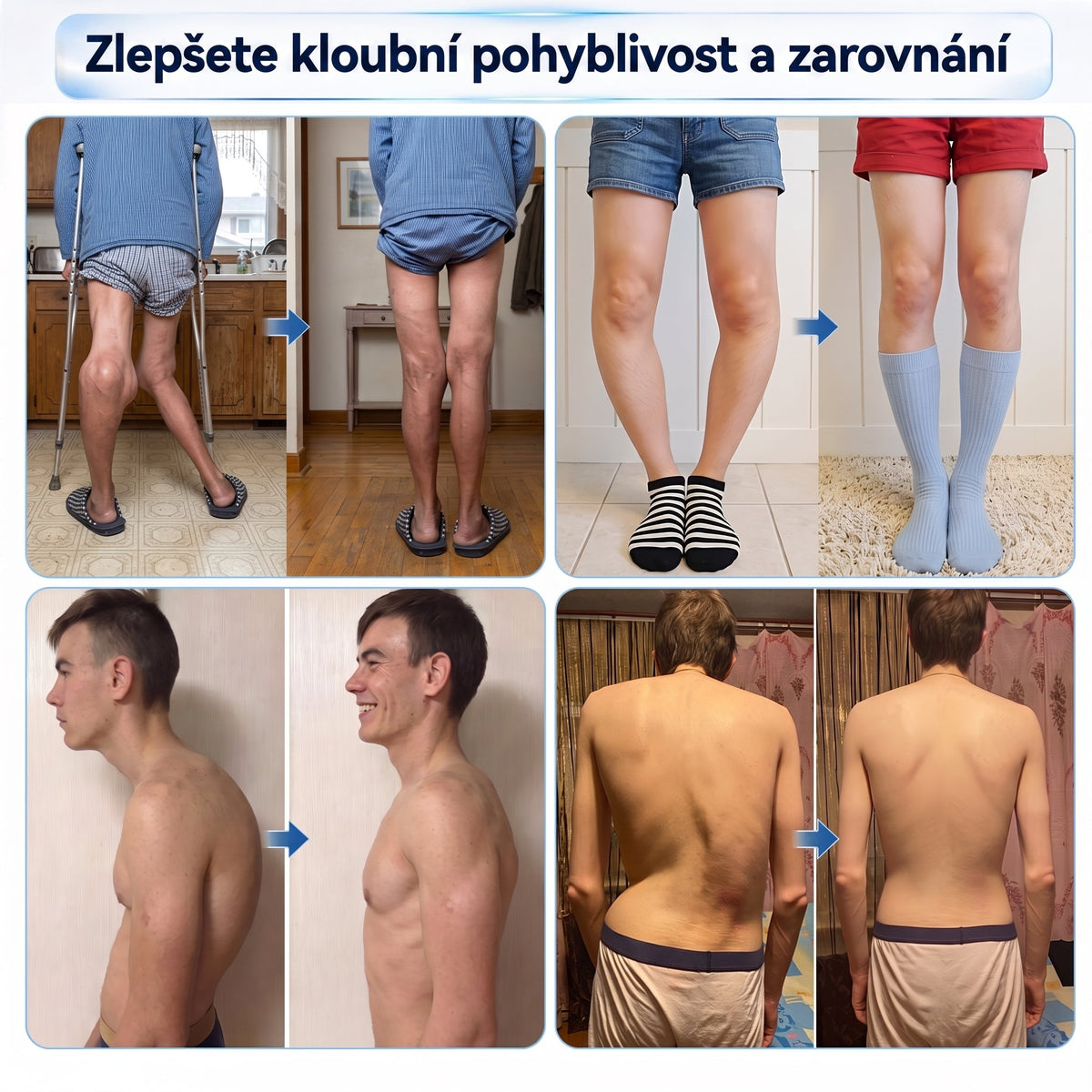 OFICIÁLNÍ OBCHOD | IFMAGIC® 0,05 mm Mikroneedle Rychle Působící Roll-On pro Úlevu Kloubů a Kostí🔥