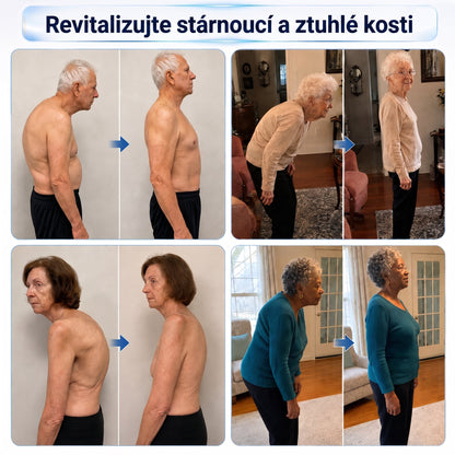 OFICIÁLNÍ OBCHOD | IFMAGIC® 0,05 mm Mikroneedle Rychle Působící Roll-On pro Úlevu Kloubů a Kostí🔥