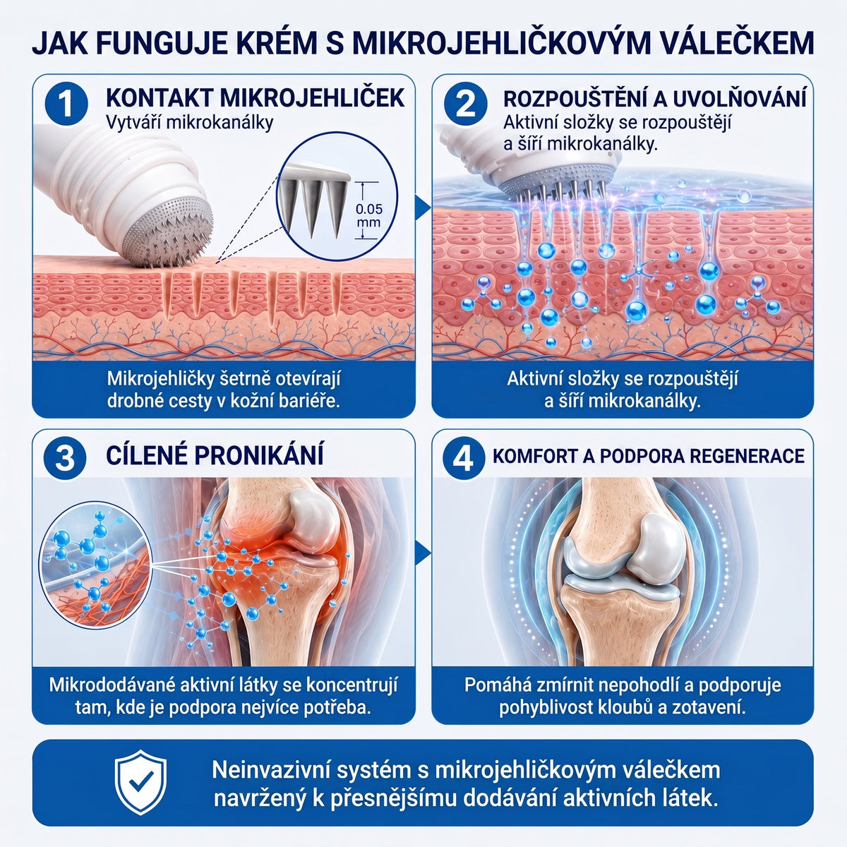 OFICIÁLNÍ OBCHOD | IFMAGIC® 0,05 mm Mikroneedle Rychle Působící Roll-On pro Úlevu Kloubů a Kostí🔥
