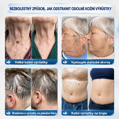 Picdo® 7‑denní krém k odstraňování kožních výrůstků a pigmentových skvrn 🧴(𝐒𝐜𝐡𝐦𝐞𝐫𝐳𝐟𝐫𝐞𝐢𝐞 𝐅𝐨𝐫𝐦𝐞𝐥 – 𝐨𝐡𝐧𝐞 𝐍𝐚𝐫𝐛𝐞𝐧) 💪