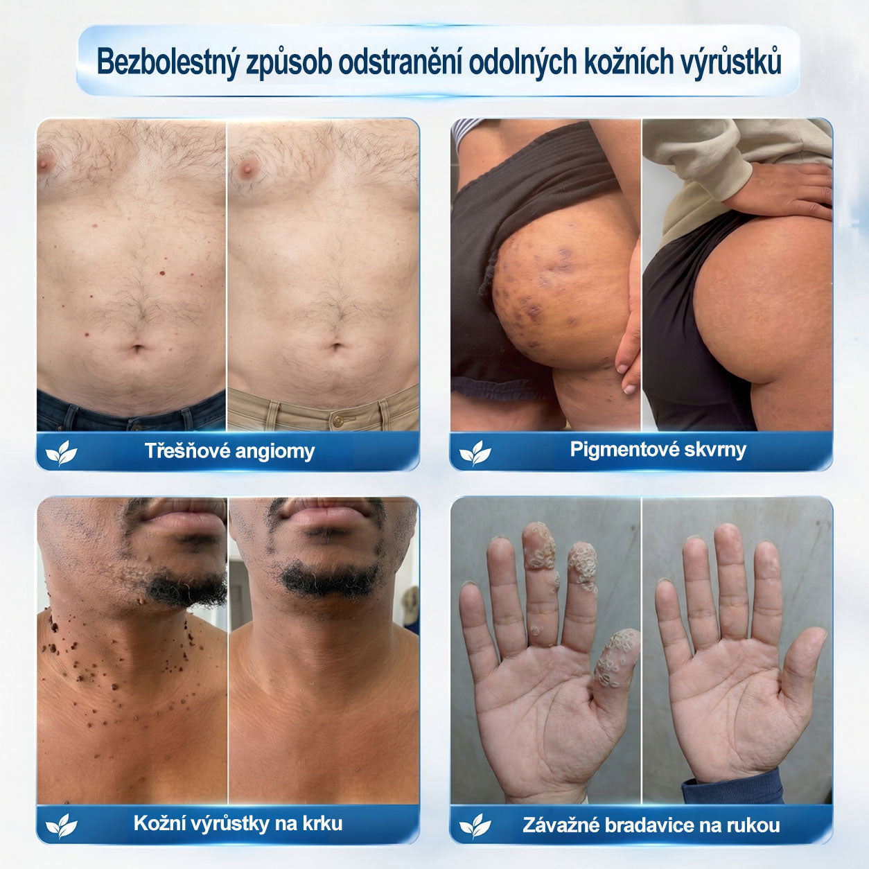 Oficiální značkový obchod |👩‍⚕️𝐏𝐢𝐜𝑑𝑜® 𝟩𝖽𝖾𝗻𝗻í 𝘰𝘥𝘴𝘵𝗋𝖺ň𝗈𝗏𝖺č 𝒔𝒌𝒗𝒓𝙣 𝙖 𝙥𝙞𝙜𝙢𝙚𝙣𝙩𝘰𝘷ý𝘤𝘩 𝘴𝘬𝖛𝖗𝖓 (Bezbolestný rollerball bez jizev)✨