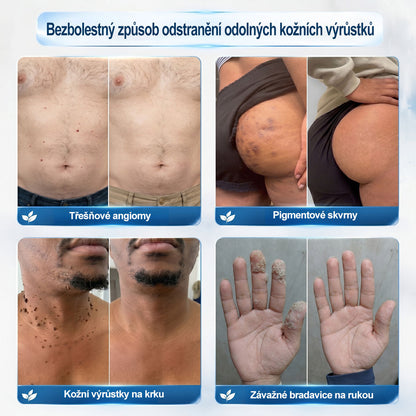Oficiální značkový obchod |👩‍⚕️𝐏𝐢𝐜𝑑𝑜® 𝟩𝖽𝖾𝗻𝗻í 𝘰𝘥𝘴𝘵𝗋𝖺ň𝗈𝗏𝖺č 𝒔𝒌𝒗𝒓𝙣 𝙖 𝙥𝙞𝙜𝙢𝙚𝙣𝙩𝘰𝘷ý𝘤𝘩 𝘴𝘬𝖛𝖗𝖓 (Bezbolestný rollerball bez jizev)✨