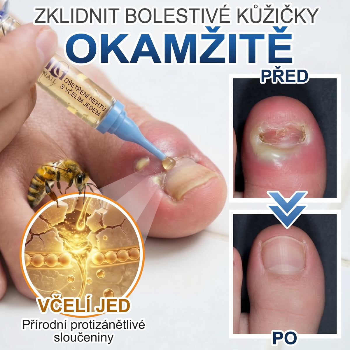 🇪🇺 Certyfikowany w UE 👩‍🔬 CareBreeze® Fungi Free – Intensywna Kuracja do Paznokci na Bazie Jadu Pszczelego ✨