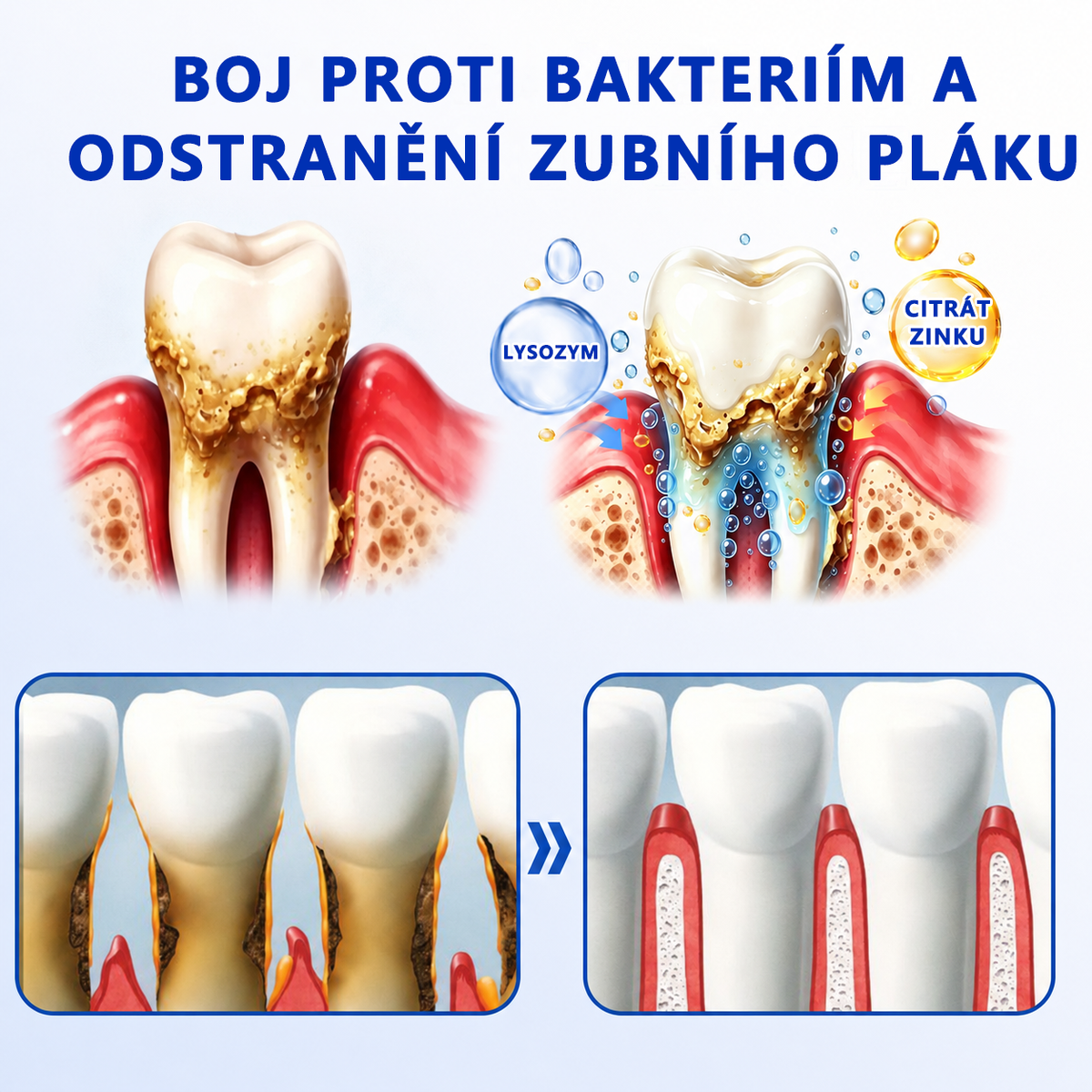 🇪🇺🏅🦷 Evolvion® GumRevive Gel na regeneraci parodontu 🔥