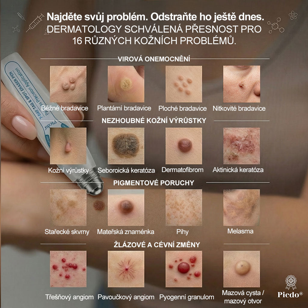 Oficiální značkový obchod |👩‍⚕️𝐏𝐢𝐜𝑑𝑜® 𝟩𝖽𝖾𝗻𝗻í 𝘰𝘥𝘴𝘵𝗋𝖺ň𝗈𝗏𝖺č 𝒔𝒌𝒗𝒓𝙣 𝙖 𝙥𝙞𝙜𝙢𝙚𝙣𝙩𝘰𝘷ý𝘤𝘩 𝘴𝘬𝖛𝖗𝖓 (Bezbolestný rollerball bez jizev)✨