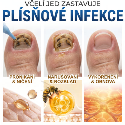 🇪🇺 Certyfikowany w UE 👩‍🔬 CareBreeze® Fungi Free – Intensywna Kuracja do Paznokci na Bazie Jadu Pszczelego ✨