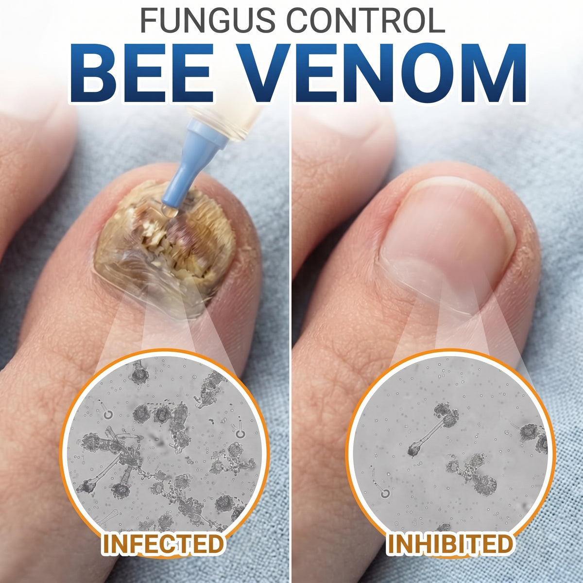 🇪🇺 Certyfikowany w UE 👩‍🔬 CareBreeze® Fungi Free – Intensywna Kuracja do Paznokci na Bazie Jadu Pszczelego ✨