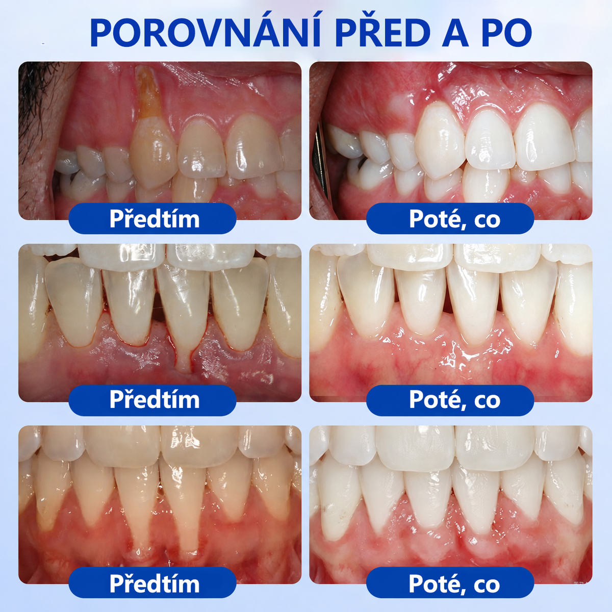 🇪🇺🏅🦷 Evolvion® GumRevive Gel na regeneraci parodontu 🔥