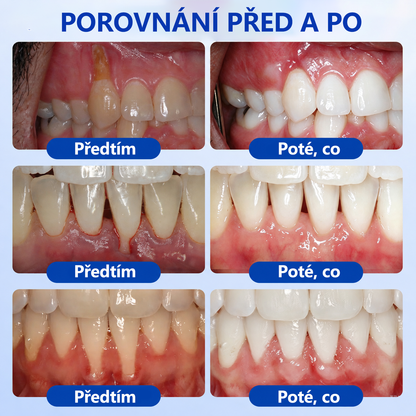🇪🇺🏅🦷 Evolvion® GumRevive Gel na regeneraci parodontu 🔥